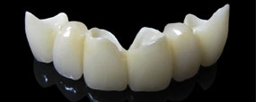 Invisalign