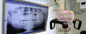 Invisalign