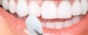 Invisalign
