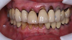 Before