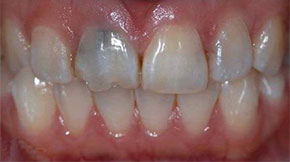 Before