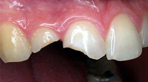 Before